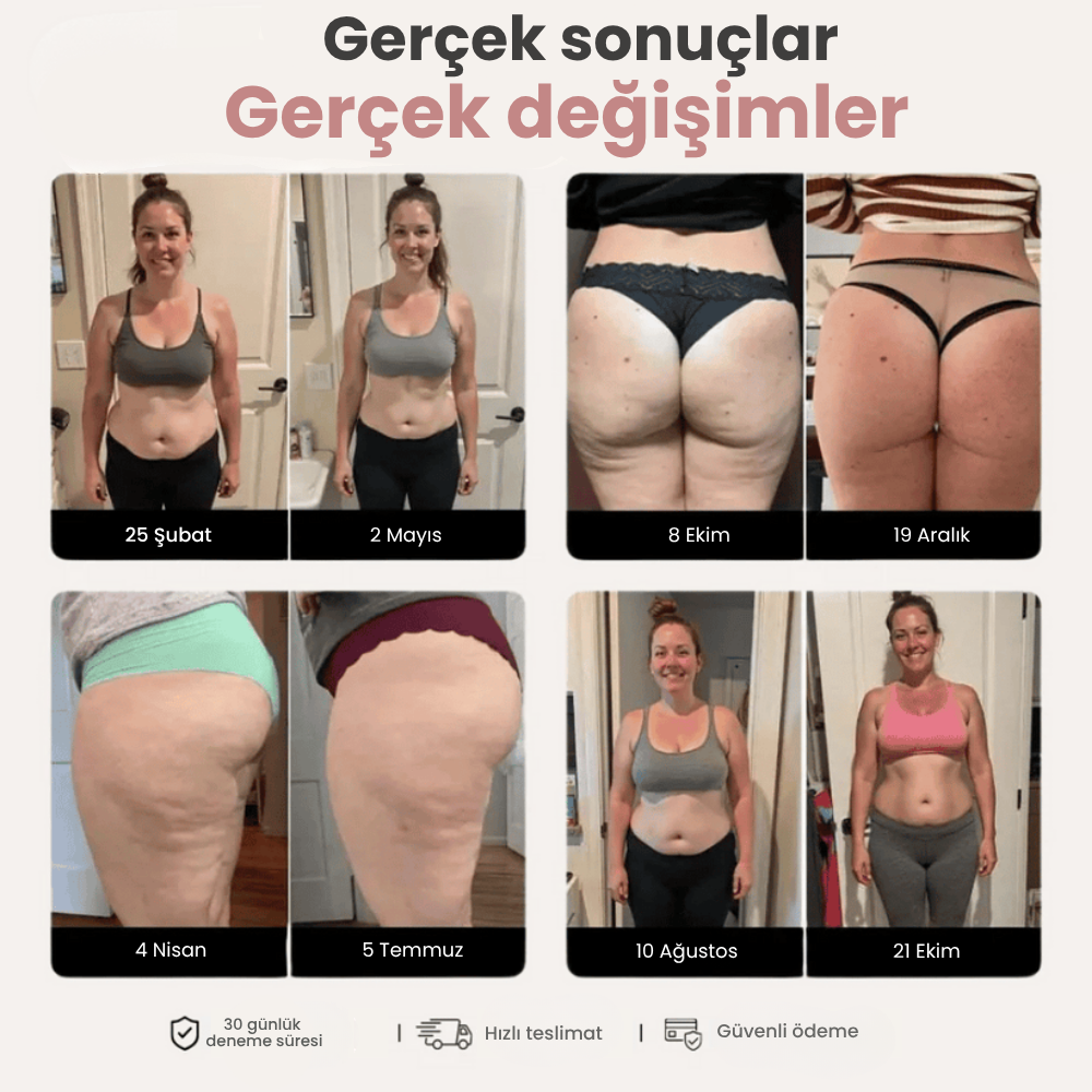 Vilèna 3D Selülit Tayt - Vücut formunu zahmetsizce yenile